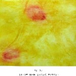 2011ad_wada3
